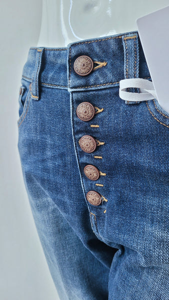 Jeans mit Knöpfen